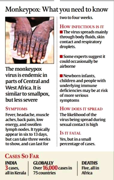 What is monkeypox and what do we know about the cases in the U.K. and  Europe? : Goats and Soda : NPR